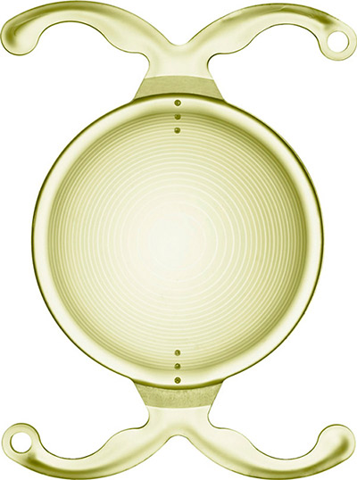 LENTE TRIFOCAL TÓRICA FINEVISION POD FT 25.5D 5.25CIL especialistas en productos y equipos para oftalmología
